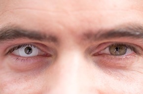 Zentralverband der Augenoptiker und Optometristen - ZVA: Halloween: Vorsicht bei farbigen Kontaktlinsen