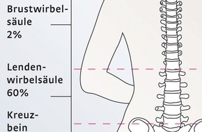 medi GmbH & Co. KG: Rückenschmerzen - fast eine Epidemie in Industriestaaten (mit Bild)