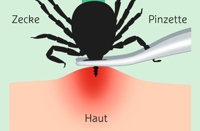 Wort & Bild Verlagsgruppe - Gesundheitsmeldungen: Zecken: Wie Eltern ihr Kind am besten schützen