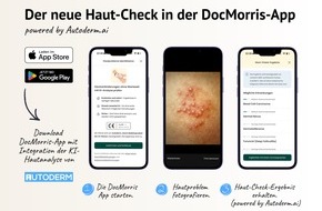 Autoderm: Autoderm erg&auml;nzt digitales Gesundheits&ouml;kosystem von DocMorris mit KI-Hautanalyse