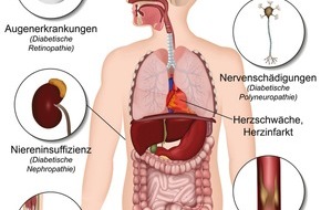 Deutscher Naturheilbund e.V.: Naturheilverfahren in der Diabetes-Leitlinie empfohlen