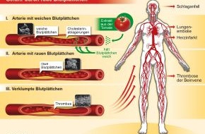 Dr. Wolz Zell GmbH: Extrakt aus der Tomate hemmt Blutverklumpung / Neues bahnbrechendes Naturpräparat sorgt für gesunden Blutfluss (BILD)