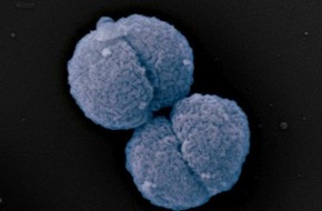 Universität Konstanz: Neue Antibiotika gegen Problemkeime, PI Nr. 29/2025