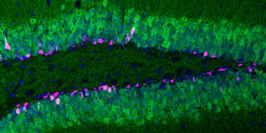 Medizinforschung: Mit Schilddrüsenhormonen gegen Lernschwächen