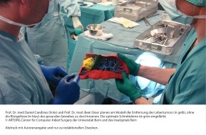 Schweizerischer Nationalfonds / Fonds national suisse: FNS: Image du mois avril 2009: Planifier une intervention chirurgicale grâce des modèles 3D individuels d'organes