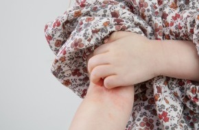 Wort & Bild Verlagsgruppe - Gesundheitsmeldungen: Neurodermitis bei Kindern: Welche Mythen wirklich stimmen / Aufgeräumt mit den gängigsten Tipps
