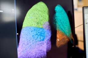 Lungenkrebsfr&uuml;herkennung kommt