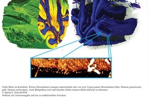 Schweizerischer Nationalfonds / Fonds national suisse: FNS: Image de la recherche août 2010 : Radiographie : un procédé fournit des vues plus précises