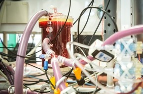 Technische Hochschule Köln: Neues Lebertransportsystem soll Schäden am Organ während der Überführung verringern