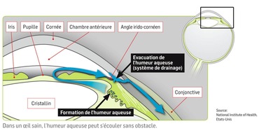 Groupe Glaucome de la Société Suisse dOphtalmologie (SSO): Examens ophtalmologiques gratuits en mars dans toute la Suisse: Une campagne de prévention des ophtalmologues suisses