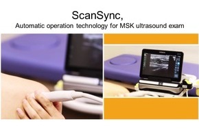 Hitachi Medical Systems Europe Holding AG: Hitachi Medical Systems Europe announces "ScanSync" - a new function for diagnostic ultrasound that reduces the burden on operators - which is to be supported by the "ARIETTA Prologue"