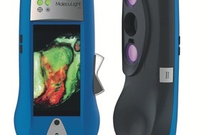 Smith & Nephew Schweiz AG: Smith & Nephew annuncia il lancio europeo di una nuova tecnologia di imaging portatile a fluorescenza, aprendo una nuova epoca di processi decisionali per la cura delle ferite basati sull'evidenza