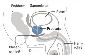 Wort & Bild Verlagsgruppe - Gesundheitsmeldungen: Prostatakrebs-Früherkennung: Das sollten Männer wissen