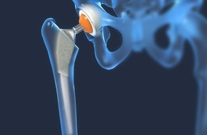 Klinikum Ingolstadt: Infoabend zu Gelenkersatz im Klinikum Ingolstadt am 29. Januar