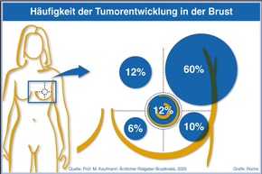 Kostenfreie Infografiken der Roche Pharma AG zum Thema Krebs (mit Bild)