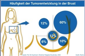 Roche Pharma AG: Kostenfreie Infografiken der Roche Pharma AG zum Thema Krebs (mit Bild)
