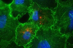 Universit&auml;tsklinikum Essen A&ouml;R: Forschende der Medizinischen Fakult&auml;t ordnen aktuelle Hantavirus-F&auml;lle ein