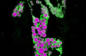 Helmholtz Munich: Scientists Reveal Adipocyte's Metabolic Role and Identify Treatment Targets