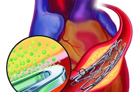 Boston Scientific Medizintechnik GmbH: Studie TAXUS WOMAN zeigt positive klinische Behandlungsresultate für den TAXUS[TM] Arzneimittel-freisetzenden Stent bei Frauen
