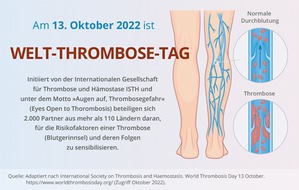 Viatris Germany GmbH: Pressemitteilung: Welt-Thrombose-Tag &ndash; Viatris setzt sich ein, f&uuml;r Risiken und Pr&auml;ventionsma&szlig;nahmen zu sensibilisieren