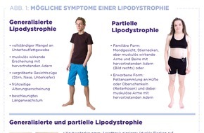 Amryt Pharma: Welt-Lipodystrophie-Tag am 31. März / Keine Fettzellen - klingt gut, ist es aber nicht