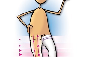 medi GmbH & Co. KG: Immer kürzere Verweildauer im Krankenhaus / Wichtig: Thromboseprophylaxe zu Hause