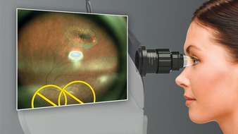 OD-OS GmbH: OD-OS GmbH at ESCRS 2023: Recent MDR certification of Navilas® underlines its advanced standard in retina lasers and opens path to new developments