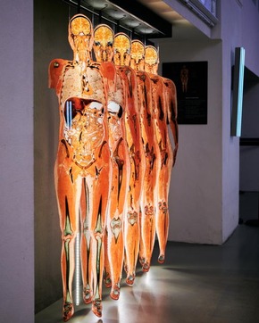 30 Years of BODY WORLDS / A Success Story That Has Changed the Way We See Ourselves