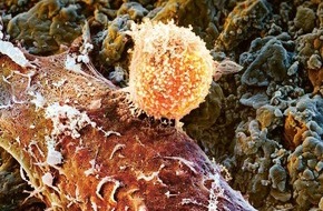 Krebsliga Schweiz: 22 millions de francs pour la recherche sur le cancer en Suisse