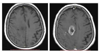 Guerbet GmbH: Meilenstein für die radiologische Diagnostik