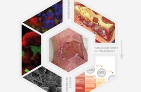 Smith & Nephew Schweiz AG: Panel di esperti per i Biofilm nelle ferite*: i Biofilm, responsabili di un ritardo nella guarigione delle ferite, si formano molto più frequentemente di quanto si sia finora supposto