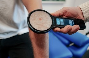 magnosco GmbH: Magnosco bringt innovative Technologie zur Hautkrebsdiagnostik auf den Markt / Magnos® mit App: Digitales, smartes Dermatoskop mit Multi-Touch-Display und hoher Farbtreue