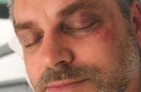 Polizeiinspektion Göttingen: POL-GÖ: (177/2025) Von Unbekannten massiv verletzt - Amtsgericht ordnet Veröffentlichung von Foto eines vor zwei Jahren in Göttingen schwer verletzten Mannes an, Hintergründe und Tatmotiv weiter ungeklärt