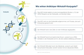 AstraZeneca/Daiichi Sankyo: Behandlungsfortschritte bei Brustkrebs geben neue Hoffnung