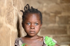 cbm Christoffel-Blindenmission e.V.: Einfache Operation, großes Wunder / Christoffel-Blindenmission schenkt Kindern Augenlicht