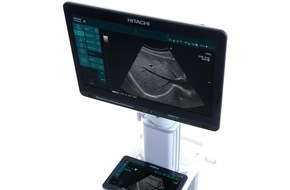 Hitachi Medical Systems Europe Holding AG: Hitachi Aloka launches two new, highly flexible Diagnostic Ultrasound Systems, ARIETTA Precision and ARIETTA Prologue
