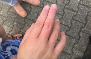 Feuerwehr Mönchengladbach: FW-MG: Finger steckt fest