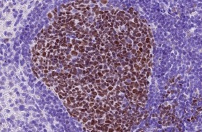 Universit&auml;t zu K&ouml;ln: Neue Angriffsstelle zur Behandlung von Lymphomen entdeckt