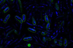 Universität Bremen: Neue Emmy Noether-Nachwuchsgruppe zu Zuckerverarbeitung von Meeresbakterien