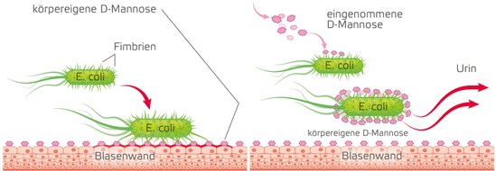 MCM Klosterfrau Vertriebsgesellschaft mbH: Wiederkehrende Blasenentzündungen - sind Antibiotika immer notwendig?