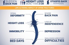 The International Osteoporosis Foundation (IOF): Ne manquez pas les signes d'une fracture de la colonne vertébrale, met en garde l'IOF GENÈVE