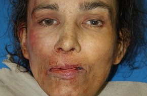 Polizeipräsidium Frankfurt am Main: POL-F: 110119 - 0076 Frankfurt-Niederrad: Unbekannte Tote  - Polizei bittet um Mithilfe - Bitte Lichtbild beachten
