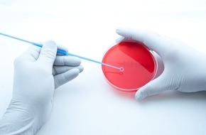 Asklepios Kliniken GmbH & Co. KGaA: Welttag der Sepsis: Wie Asklepios die gefährliche Infektion bekämpft