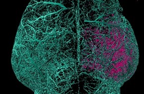 Universität Duisburg-Essen: Sauerstoffmangel während der Geburt: Von schädlichen zu heilenden Immunzellen
