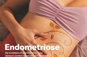 Wort & Bild Verlagsgruppe - Gesundheitsmeldungen: Endometriose: Viele Frauen leiden während der Periode / Noch immer weiß die Medizin zu wenig über die chronisch-entzündliche Erkrankung / Doch allmählich rückt sie stärker in den Fokus der ...