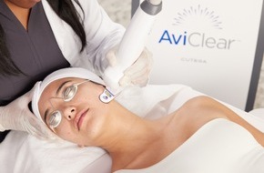 Cutera: AviClear: Akne jetzt direkt an der Wurzel behandeln