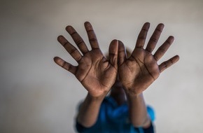 Deutsche Stiftung Weltbevölkerung (DSW): Horror für 450 Mädchen jede Stunde: Internationaler Tag gegen weibliche Genitalverstümmelung