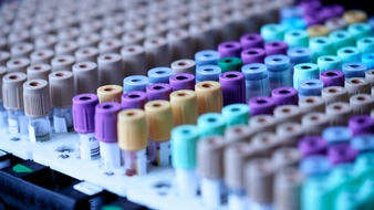 bioM&eacute;rieux: Aktuelle Untersuchung zeigt: Ein fr&uuml;hzeitiger Einsatz von schneller Labordiagnostik k&ouml;nnte in Deutschland j&auml;hrlich rund 3.800 Todesf&auml;lle durch Sepsis vermeiden und ca. 153 Millionen Euro einsparen