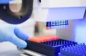 Universit&auml;tsklinikum Essen A&ouml;R: F&ouml;rderung des Bundes: 580.000 Euro f&uuml;r die Westdeutsche Biobank Essen