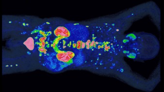 Universität Duisburg-Essen: PROMISE erhält Preis der Deutschen Hochschulmedizin: Neue Methode verbessert Prognose und Therapie von Prostatakrebs